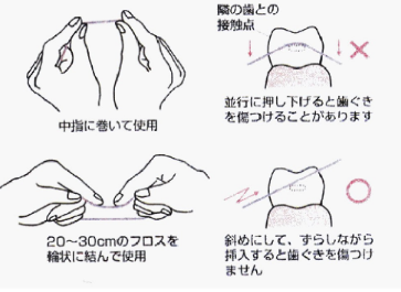 デンタルフロス
